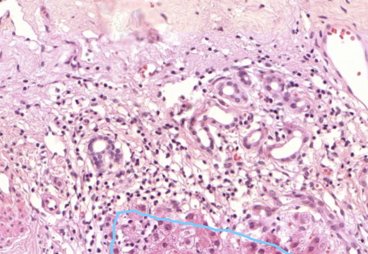 Histopathologisches Bild: Kolonschleimhaut